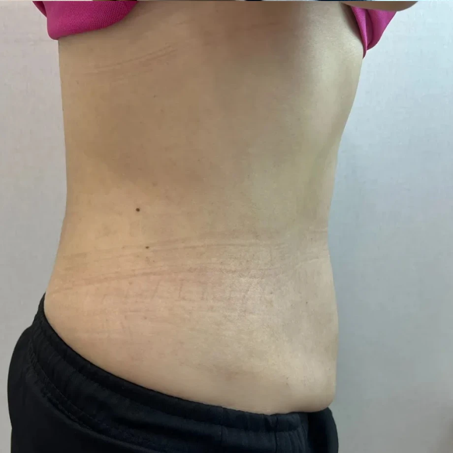 이엠365의원 이엠365의원 비만클리닉 다이어트병원 위고비 비만센터 고지혈증 고혈압 당뇨병 성인병 지방분해 지방분해주사 체지방감량