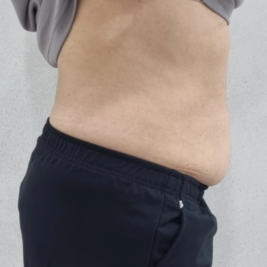 이엠365의원 이엠365의원 비만클리닉 다이어트병원 위고비 비만센터 고지혈증 고혈압 당뇨병 성인병 지방분해 지방분해주사 체지방감량