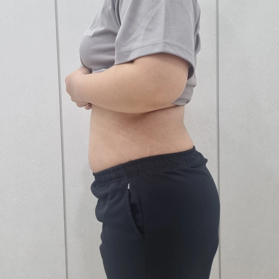 이엠365의원 이엠365의원 비만클리닉 다이어트병원 위고비 비만센터 고지혈증 고혈압 당뇨병 성인병 지방분해 지방분해주사 체지방감량